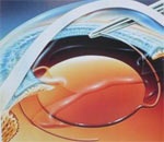 В этом году в Харькове бесплатно проведут 400 операций по удалению катаракты