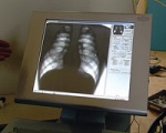 Вредное обследование. На обновление флюорографического оборудования в харьковских больницах нужно около 20 миллионов гривен