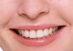 Как делают золотые зубы? В канун Дня стоматолога харьковские дантисты расскрывают свои секреты