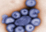 Эпидемия «свиного» гриппа в Украине может начаться уже в ноябре