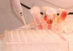 Город намерен инициировать покупку лаборатории для диагностики калифорнийского гриппа