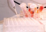 Город готов выделить на лабораторию для диагностики гриппа полмиллиона гривен