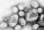 Минздрав: В Украине лабораторно подтверждены 166 случаев заболевания гриппом А (H1N1)