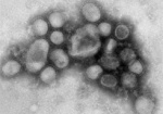 В Харькове подтвердились 14 случаев заболевания калифорнийским гриппом