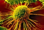 Сегодня - Всемирный день борьбы с раковыми заболеваниями