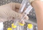 СЭС во время Евро-2012 займется ежедневным мониторингом инфекционных болезней