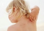 Харьковчан научат бороться с заболеваниями кожи
