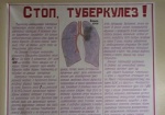 В Украине уменьшается количество больных туберкулезом - ВОЗ