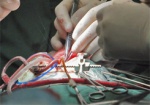 Украинские кардиологи просят государство финансировать операции на сердце