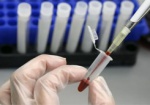 Вспышка гепатита на Балаклейщине: заболели почти 30 человек