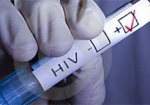 Только 70% людей в мире знают о своем положительном ВИЧ-статусе - ВОЗ